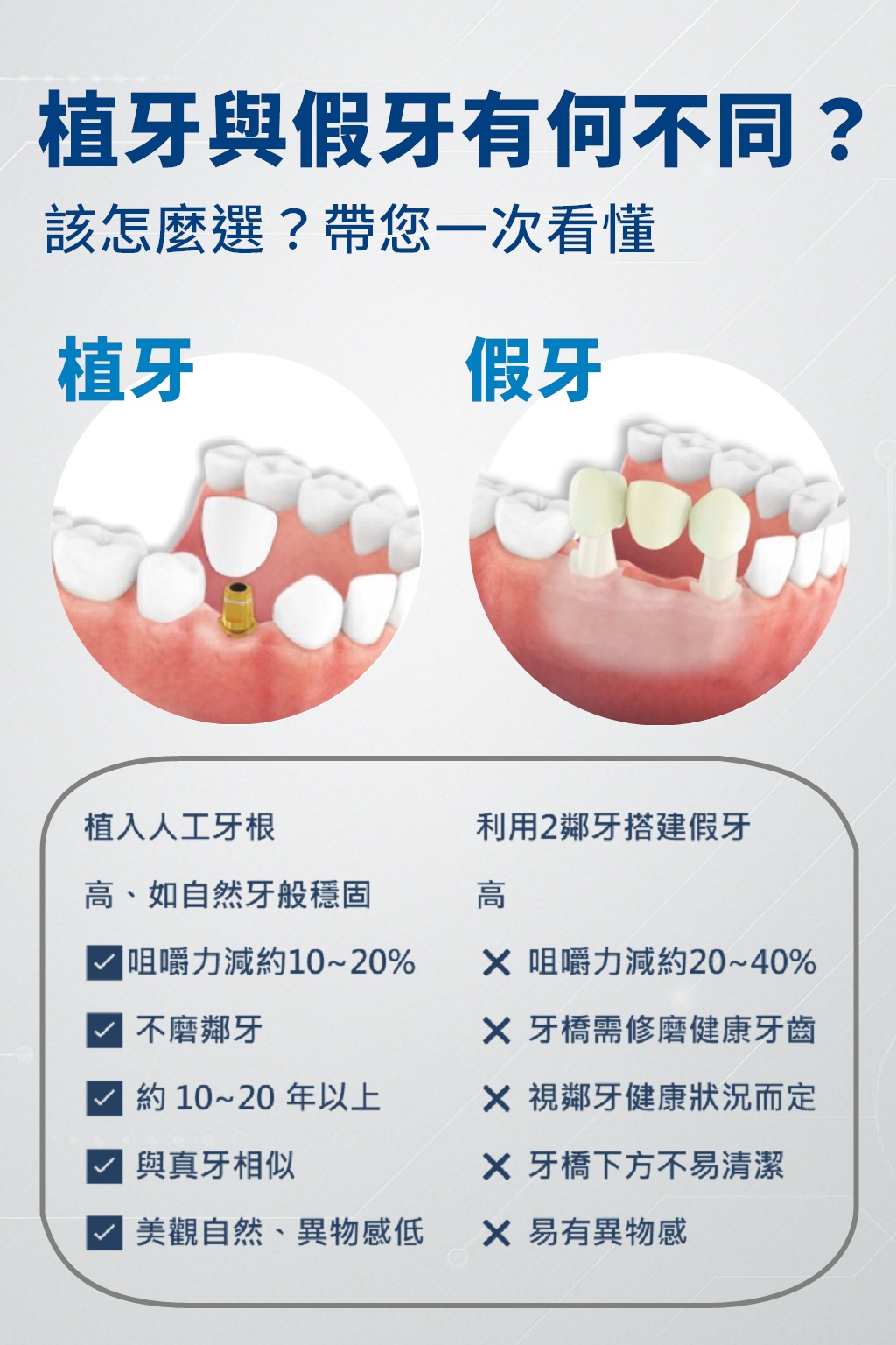 植牙和假牙的差異