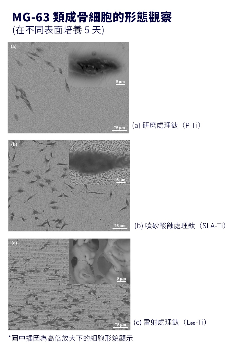 PDL雷射表處鈦細胞數最多