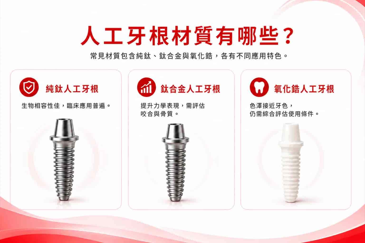 人工牙根材質有哪些？