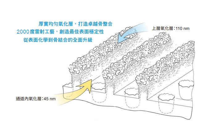 PDL雷射處理植體表面形成上下層厚實TiO₂氧化層