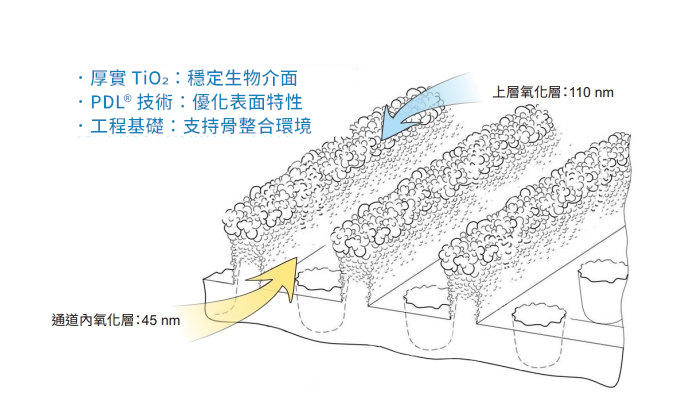 PDL雷射處理植體表面形成上下層厚實TiO₂氧化層